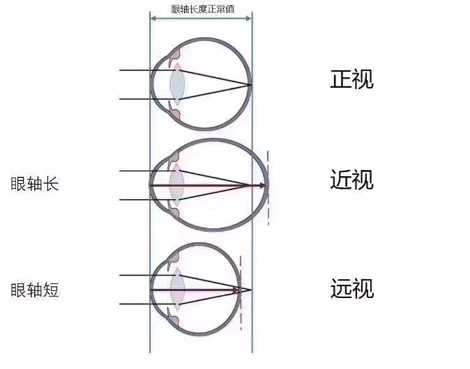 共同呵護(hù)好孩子的眼睛，讓他們擁有一個(gè)光明的未來(lái)